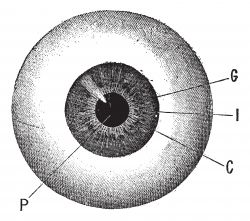 Keratitis