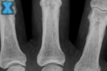 Unduh X-ray Scanner (gratis) Android - Download X-ray Scanner