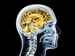 Neuralgia Trigeminal